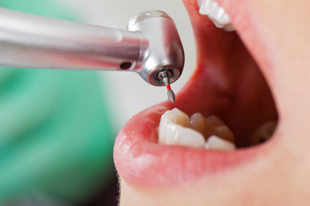 Best Emergency Dental Care for Broken or Chipped Teeth in El Cenizo, TX